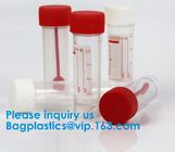 Disposable Urine Specimen Cup/Urine Sample Containers/Urine Collection Cup,Sterile Disposable Hospital Sample 60ml 100