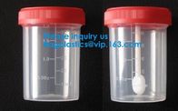 Sterile Disposable Hospital Sample 60ml 100 120 Ml Test Measurement Collection Urine Collector Cup Container