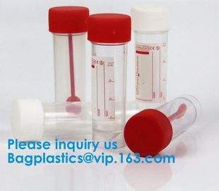 Disposable Urine Specimen Cup/Urine Sample Containers/Urine Collection Cup,Sterile Disposable Hospital Sample 60ml 100