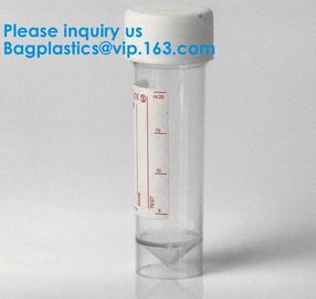 Sterile Disposable Hospital Sample 60ml 100 120 Ml Test Measurement Collection Urine Collector Cup Container